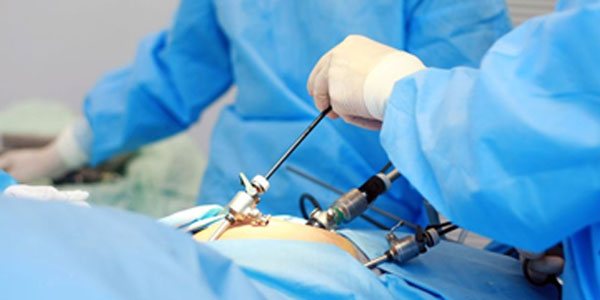 Gynecological laparoscopy surgeries